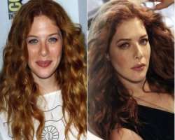 Rachelle Lefevre before surgery